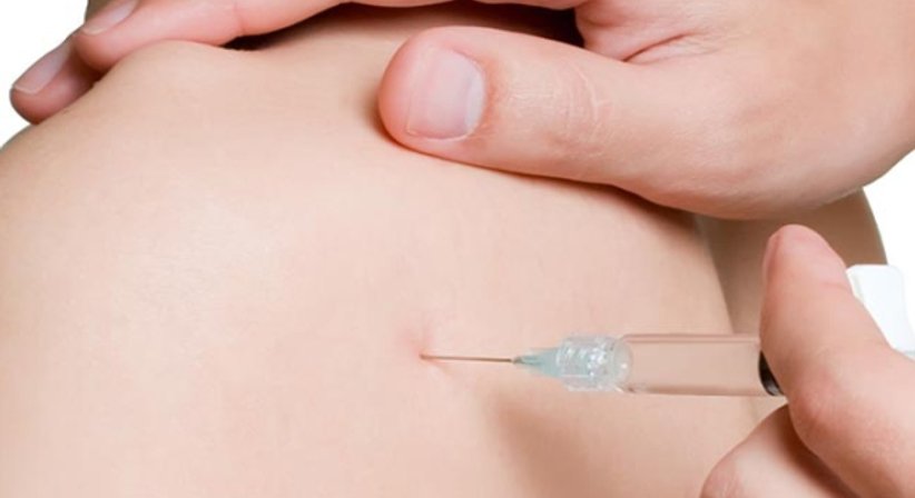 Infiltrationstherapie - Dr. Gerhard Kainz - Orthopäde Wien 1130