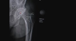 Dr. Gerhard Kainz - Orthopäde Wien 1130