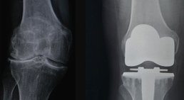 Dr. Gerhard Kainz - Orthopäde Wien 1130