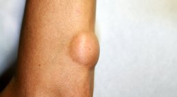 Ambulante Hautchirurgie -