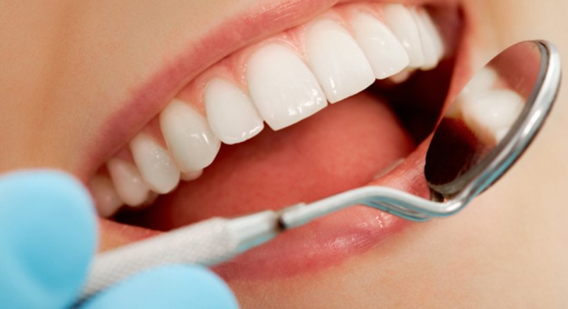 Parodontale Prophylaxe - Dr.med.univ. Michael Truppe - Zahnarzt Wien 1080