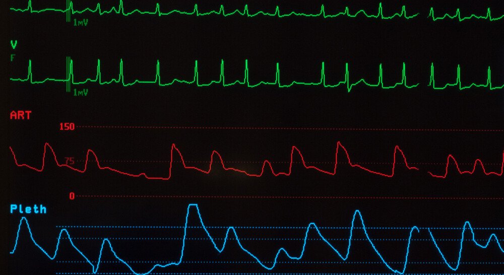 OÄ Dr. Nike Preis - Elektrokardioversion | Kardiologin in 1080 Wien - DocFinder.at