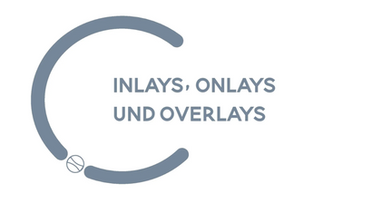 Inlays, Onlays, Overlays