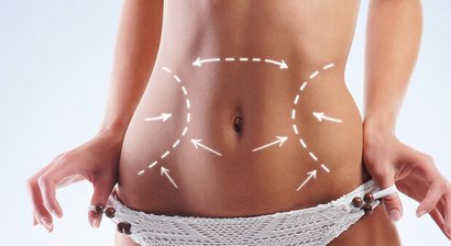 Bauchdeckenstraffung