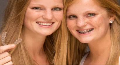 Festsitzende Zahnspange