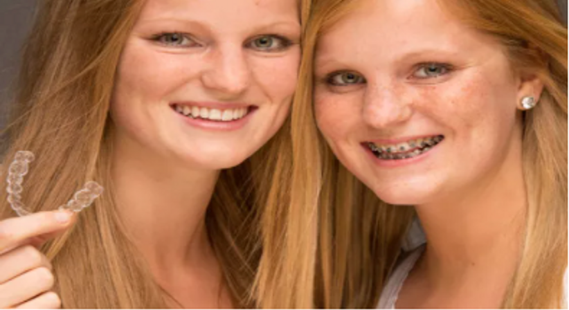 Festsitzende Zahnspange - Dr. med. dent. Alexander Sawaljanow - Zahnarzt Wien 1140