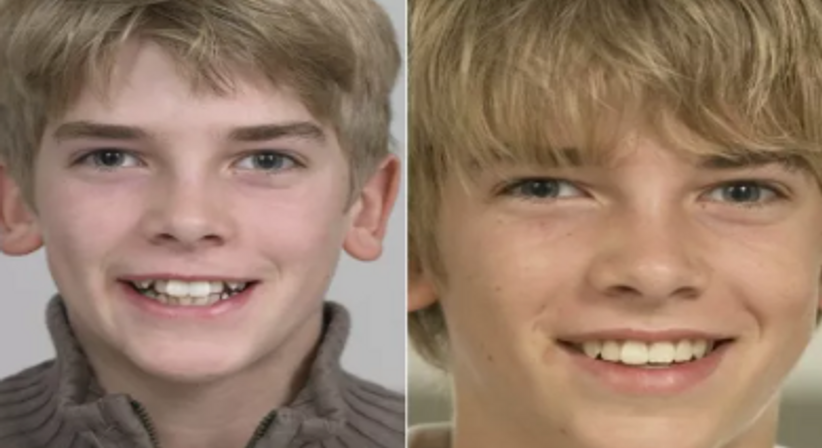 Gratis Zahnspange - Dr. med. dent. Alexander Sawaljanow - Zahnarzt Wien 1140