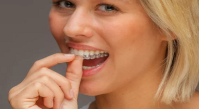 Aufbissschiene (Bruxismus, Zähneknirschen)