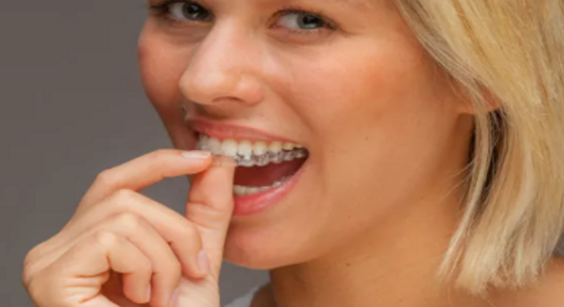 Aufbissschiene (Bruxismus, Zähneknirschen) - Dr. med. dent. Alexander Sawaljanow - Zahnarzt Wien 1140