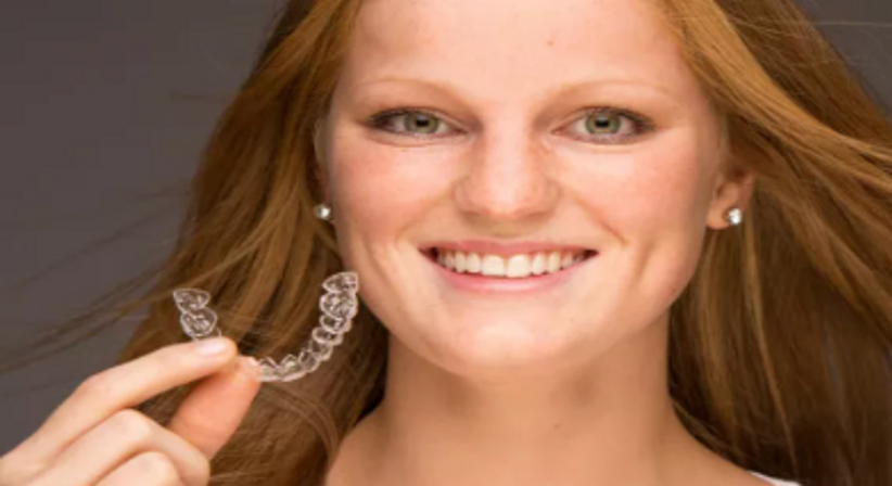 Unsichtbare Zahnspange - Dr. med. dent. Alexander Sawaljanow - Zahnarzt Wien 1140