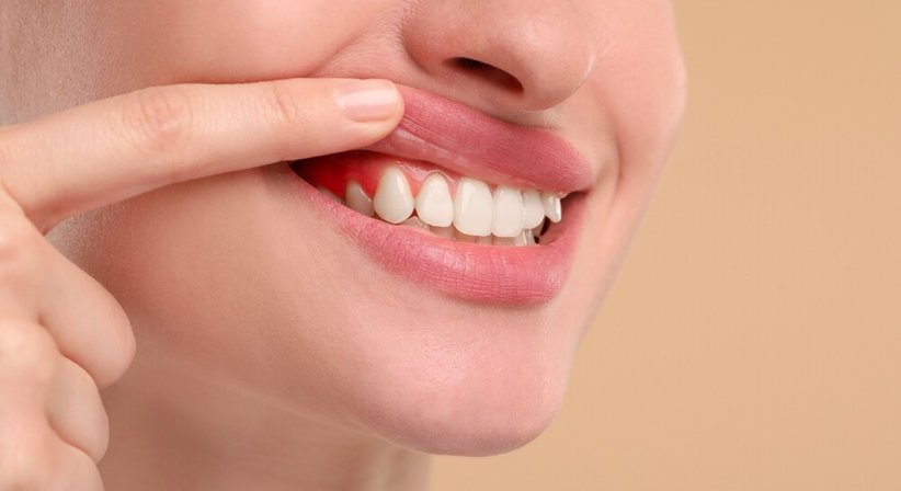 Parodontologie & Zahnfleischbehandlung bei Dr. Sera Eren