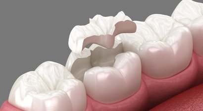 Zahnerhalt und Generalsanierung