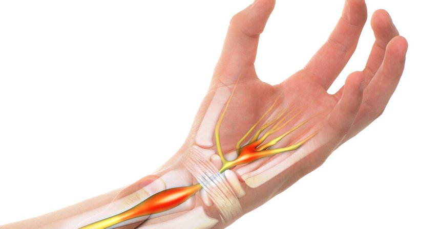 Handchirurgie - Dr. Matthias Kolloros - Plastischer Chirurg Judenburg 8750