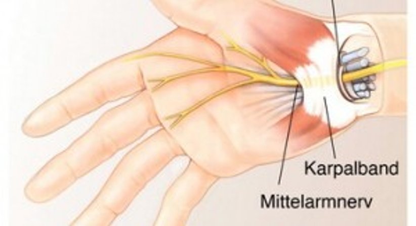 Handchirurgie - Dr. Matthias Kolloros - Plastischer Chirurg Judenburg 8750