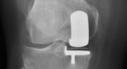 Dr. med. univ. Manuel Steiger, FEBOT - Orthopäde Parndorf 7111