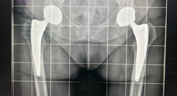 Dr. med. univ. Manuel Steiger, FEBOT - Orthopäde Parndorf 7111