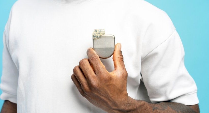 Herzrhythmusstörungen - Prof. Priv.-Doz. DDr. Robert Zilberszac - Internist Wien 1190