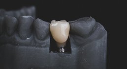 Dr. med. univ. Dr. med. dent. Jangi Akhondi - Zahnarzt 1130 Wien