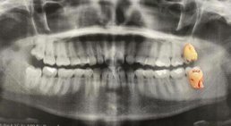 Dr. med. univ. Dr. med. dent. Jangi Akhondi - Zahnarzt 1130 Wien
