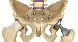 Dr. Johannes Bonomo - Orthopäde Wien 1160