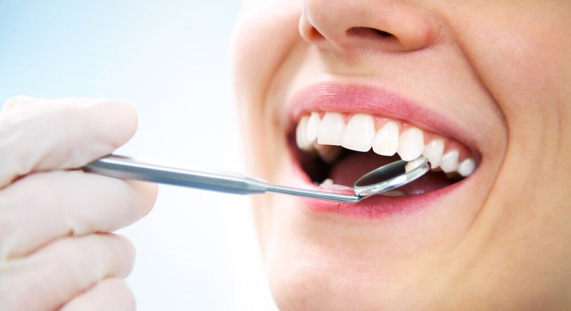 Kompositfüllungen - Dr. Gerhard Zips - Zahnarzt Wien 1150