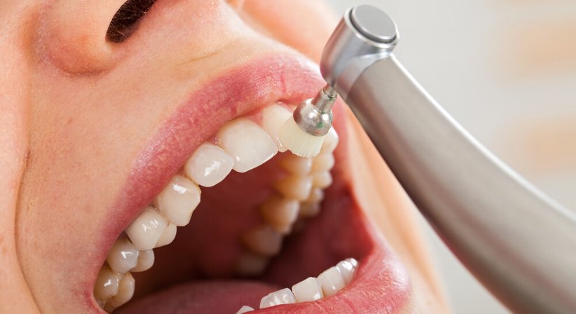 Prophylaxe / Professionelle Mundhygiene - Dr. Gerhard Zips - Zahnarzt Wien 1150