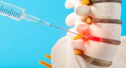 Neuraltherapie (Infiltrationen)