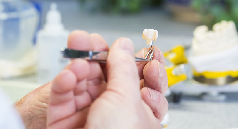 Inlays - DDr. Andreas Pinter - Zahnarzt Wien 1180