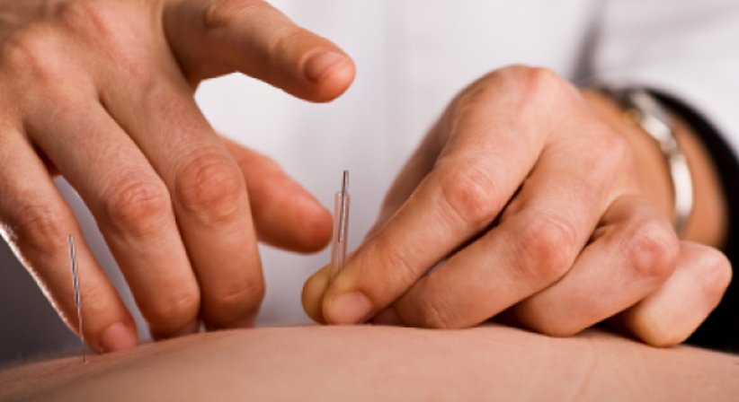 Akupunktur - Dr. Manuel Scharrer, MBA - Orthopäde Wien 1100