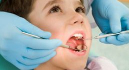 Zahnversiegelung bei Kindern -
