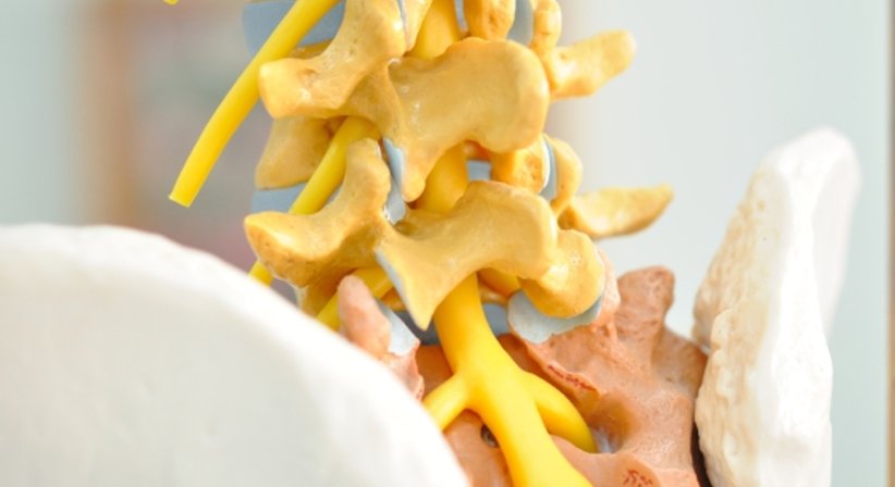 Bandscheibenvorfall - Dr. Babak Parsaei - Neurochirurg Linz 4020