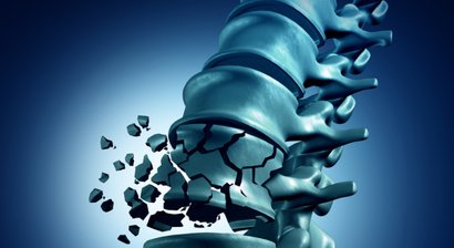 Wirbelsäule (Wirbelsäulenchirurgie)