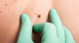 Priv. Doz. Dr. Nikolaus Duschek, PhD - Hautarzt 1010 Wien