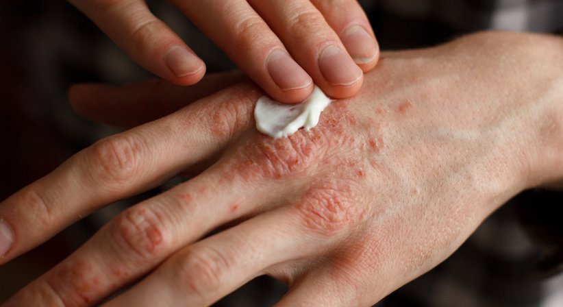 Allgemeine Dermatologie - Priv. Doz. Dr. med. Nikolaus Duschek, PhD - Hautarzt Wien 1190