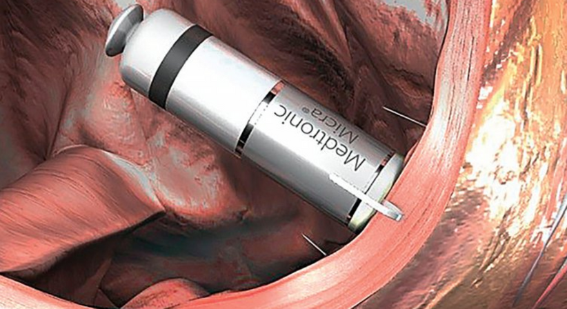 Kabelos Schrittmacher - Dr. med. univ. Cesar Khazen Vielma - Herzchirurg Wien 1010