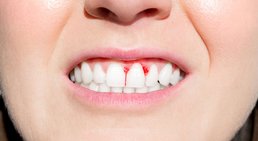 Spezialambulanz Parodontologie - Standort Simmering -  Wien 1110