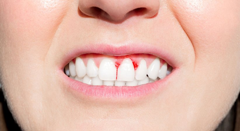 Spezialambulanz Parodontologie - Standort Simmering -  Wien 1110