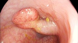 Dr. Rainer Watzak - Internist Wien 1200