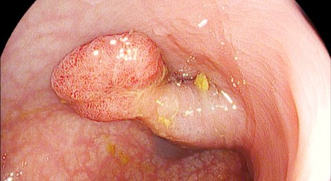Dr. Rainer Watzak - Internist Wien 1200