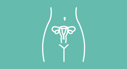 Uterus Myomatosus
