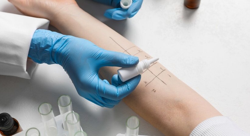 Allergiediagnostik - Dr. Nikolaus Fischer - Lungenfacharzt Wien 1190