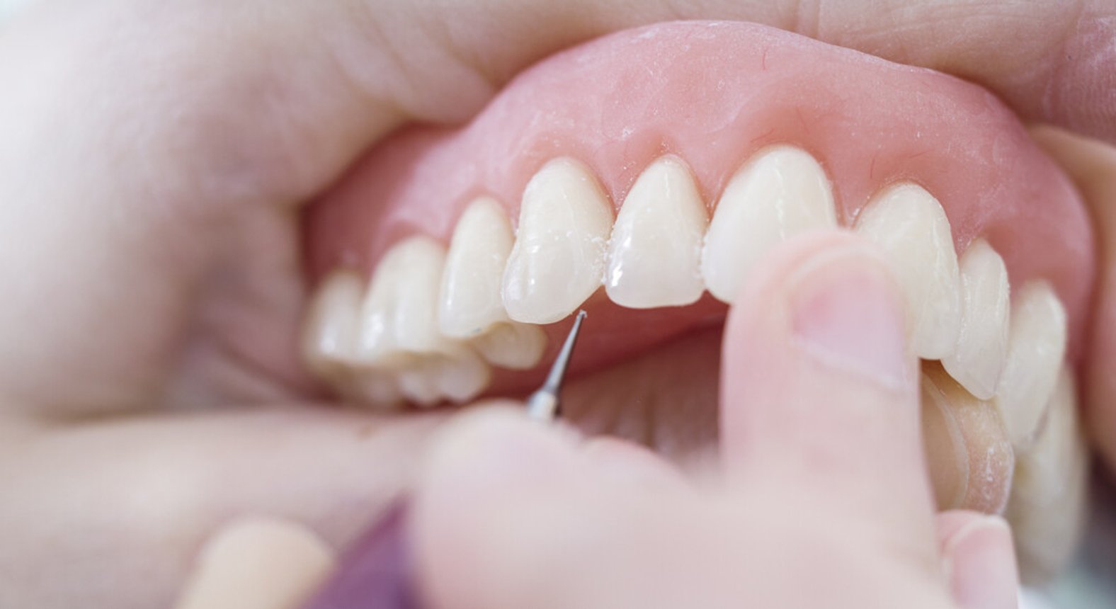 Dr. Daniela Crupinschi - Prothetische Versorgung | Zahnarzt in 1060