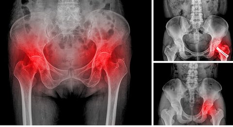 OA Dr. Gerhard Klein - Orthopäde Wien 1080