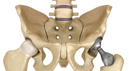 OA Dr. Gerhard Klein - Orthopäde Wien 1080