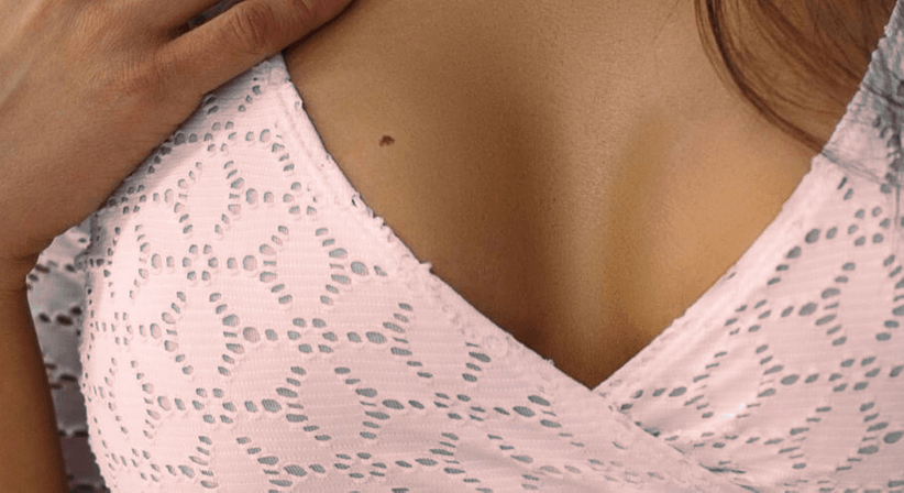 Brustrekonstruktion - Univ.-Prof. Dr. Florian Fitzal, F.E.B.S MBA - Allgemeinchirurg Wien 1180