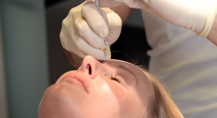 Faltenbehandlung mit Botox und Filler - Dr. Klaus Toblier - Hautarzt Baden 2500