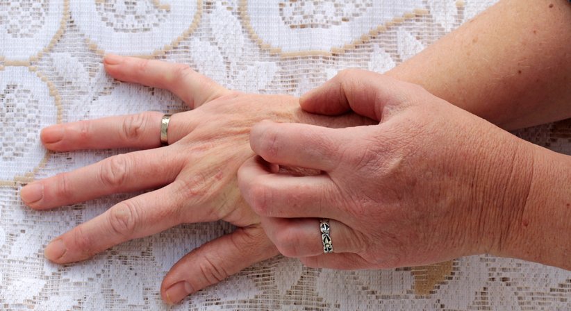 Neurodermitis (Atopisches Ekzem) - Dr. Klaus Toblier - Hautarzt Baden 2500