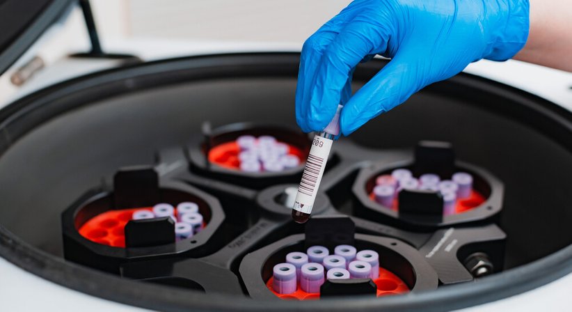 Autologe Zelltherapie - Dr. Klaus Toblier - Hautarzt Baden 2500