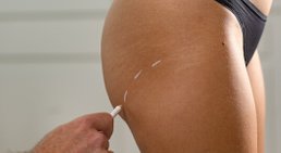 Priv.-Doz. Dr. Stefan Hacker, FEBOPRAS - Plastischer Chirurg Wien 1080