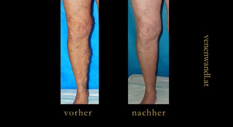 Dr. Ernst Wandl - Radiologe Wien 1070